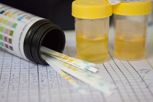 two urine drug test samples