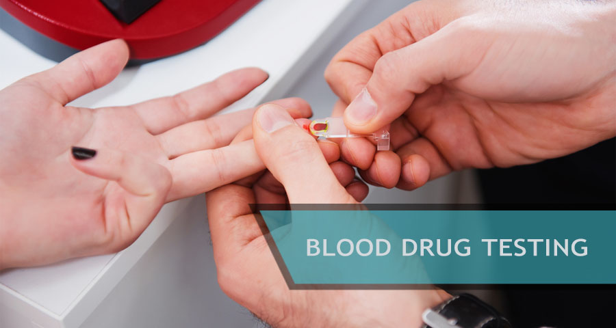 Blood Drug Test: Facts, Pros and Cons, Detection Window