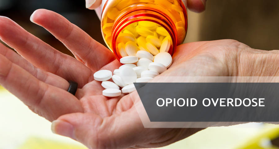 opioids on the hand