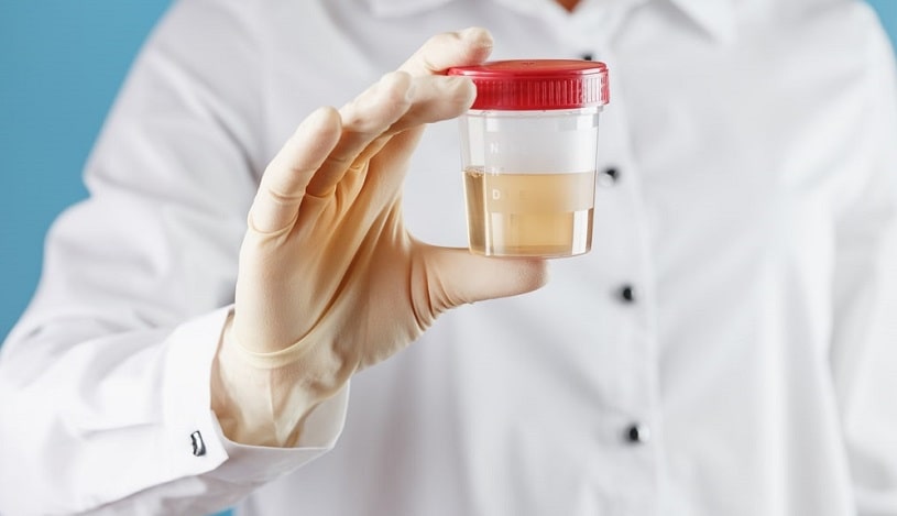 A doctor holds a urine sample.