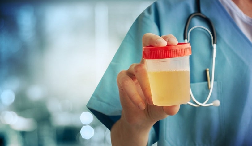 Urine testing for substance abuse.