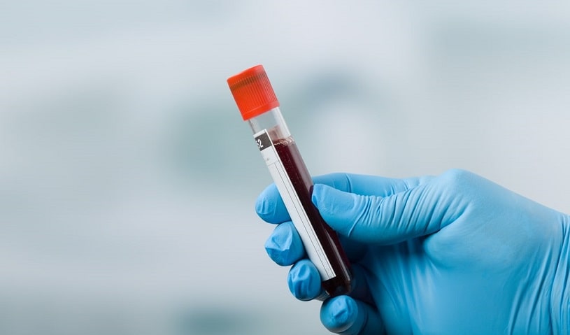 Scientist holds a blood probe.