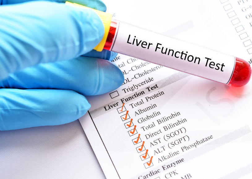 Blood sample for liver function test.
