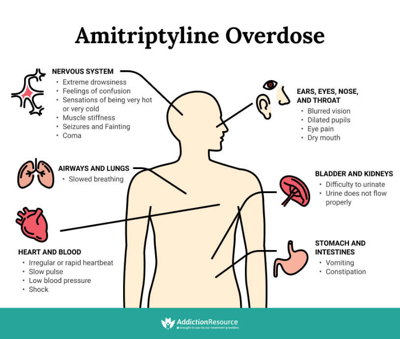 Amitriptyline Overdose Infographics