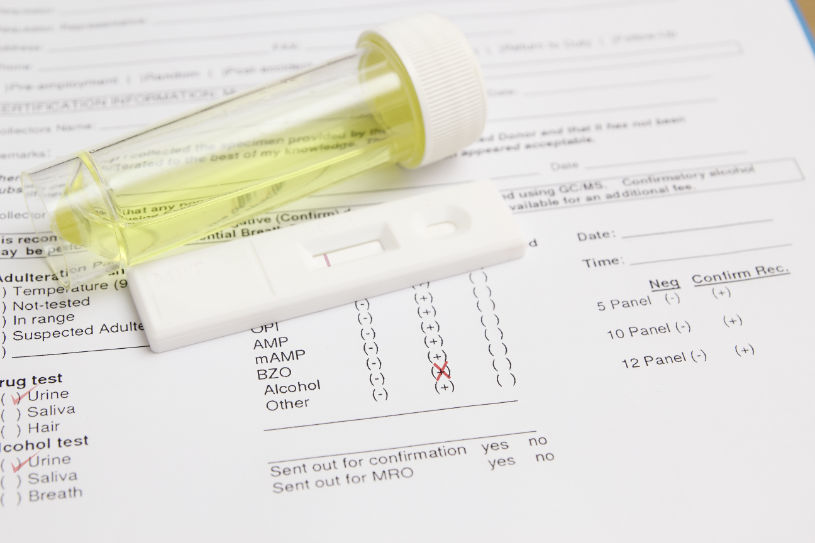 Phenobarbital drug test results paper.