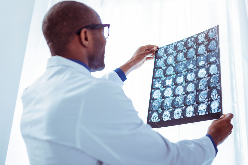 A doctor looks at brain roentgen image.