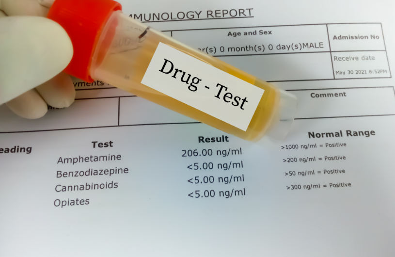 Benzos drug testing results.